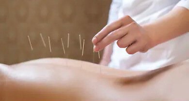 Acupuncture in action